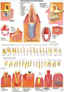 Erkrankte und gesunde Zähne